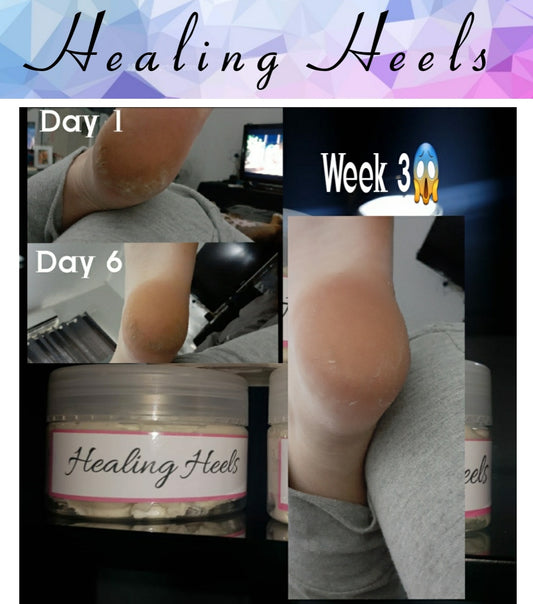 120g Healing Heels